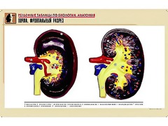 Рельефная таблица "Почка. Фронтальный разрез" (формат А1, матовое ламинирование) - fgospostavki.ru - Ейск