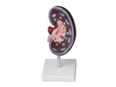 Модель почки в разрезе - fgospostavki.ru - Ейск