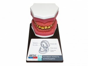 Демонстрационная модель "Ротовая полость курильщика" - fgospostavki.ru - Ейск