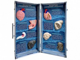 Учебно-демонстрационный кейс "Последствия употребления алкоголя и наркотиков" - fgospostavki.ru - Ейск