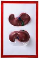 Барельефная модель "Печень" - fgospostavki.ru - Ейск